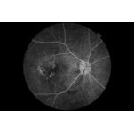 Non-Mydriatic Retinal Camera TRC-NW8 / 8F / 8F Plus
