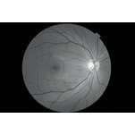 Non-Mydriatic Retinal Camera TRC-NW8 / 8F / 8F Plus